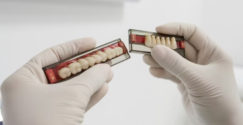 Sélection de dents prothétiques haut de gamme